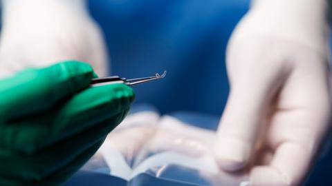 Tissue bank monitoring - corneal ring implant